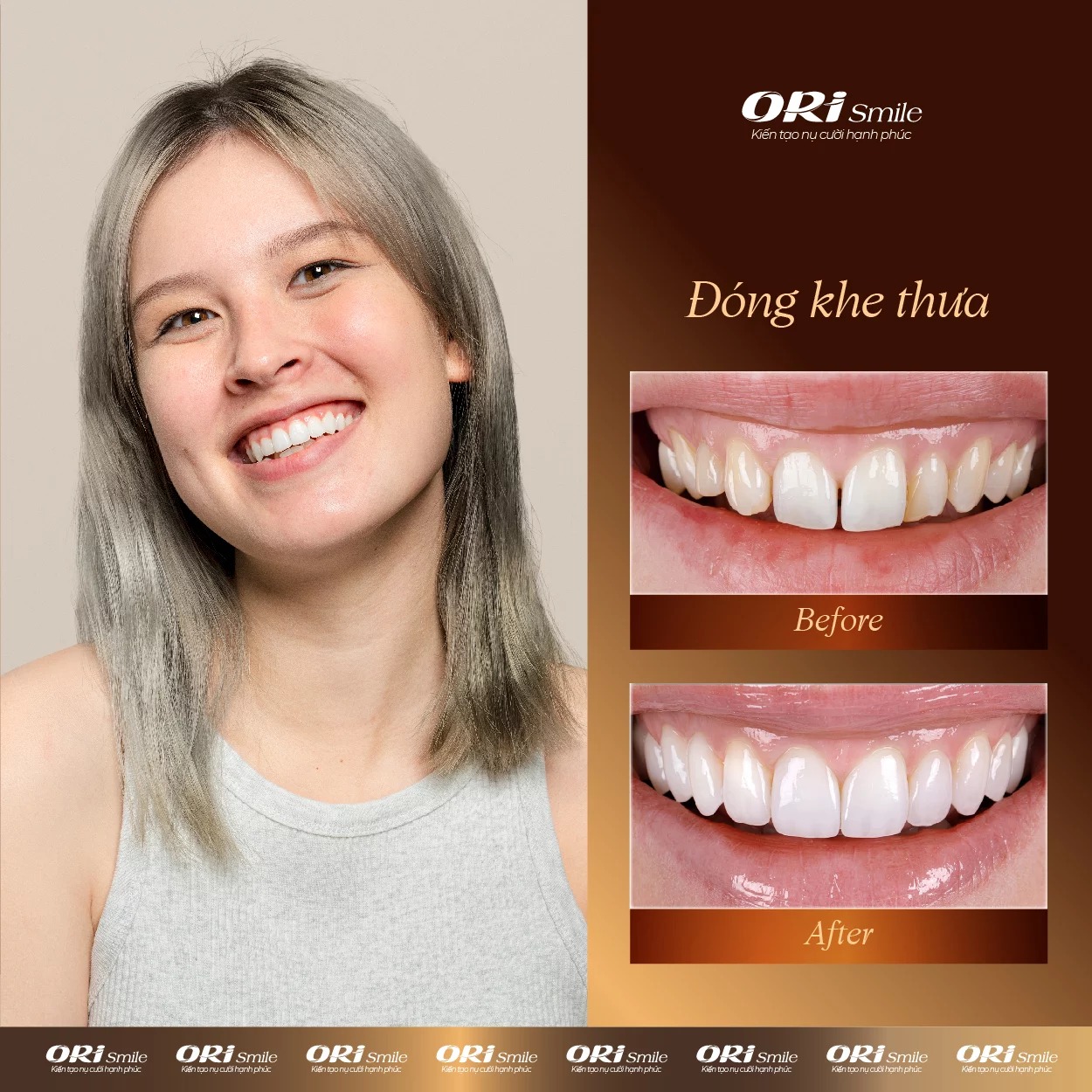 Hình ảnh khách hàng sử dụng dịch vụ tại Ori Smile