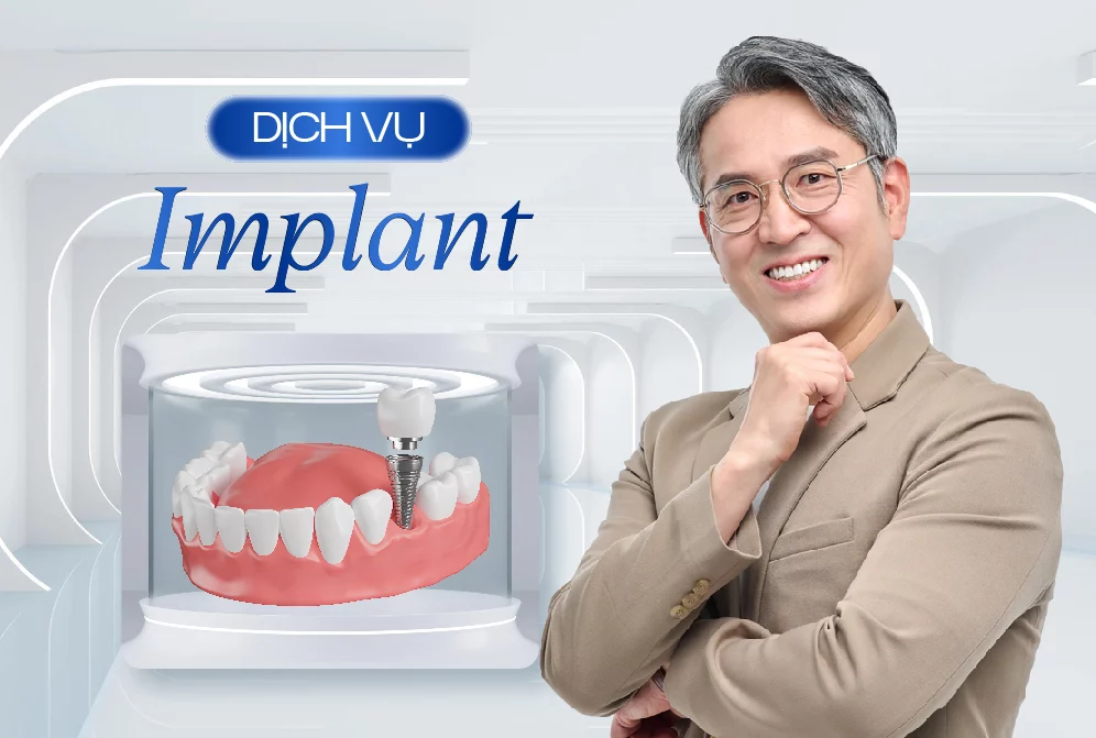 Trồng Implant