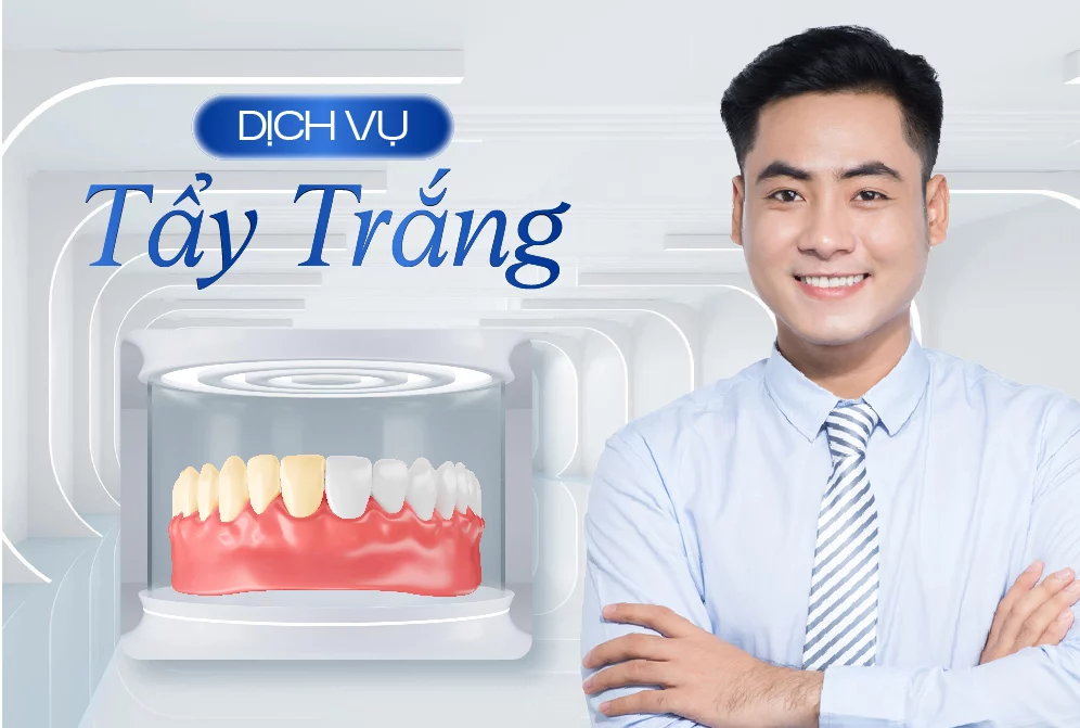 Tẩy trắng răng