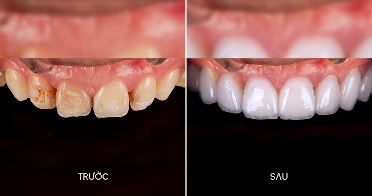 Nha khoa Ori Smile, Trung tâm nha khoa Ori Smile, Phòng khám nha khoa Ori Smile, Nha khoa thẩm mỹ quốc tế Ori Smile