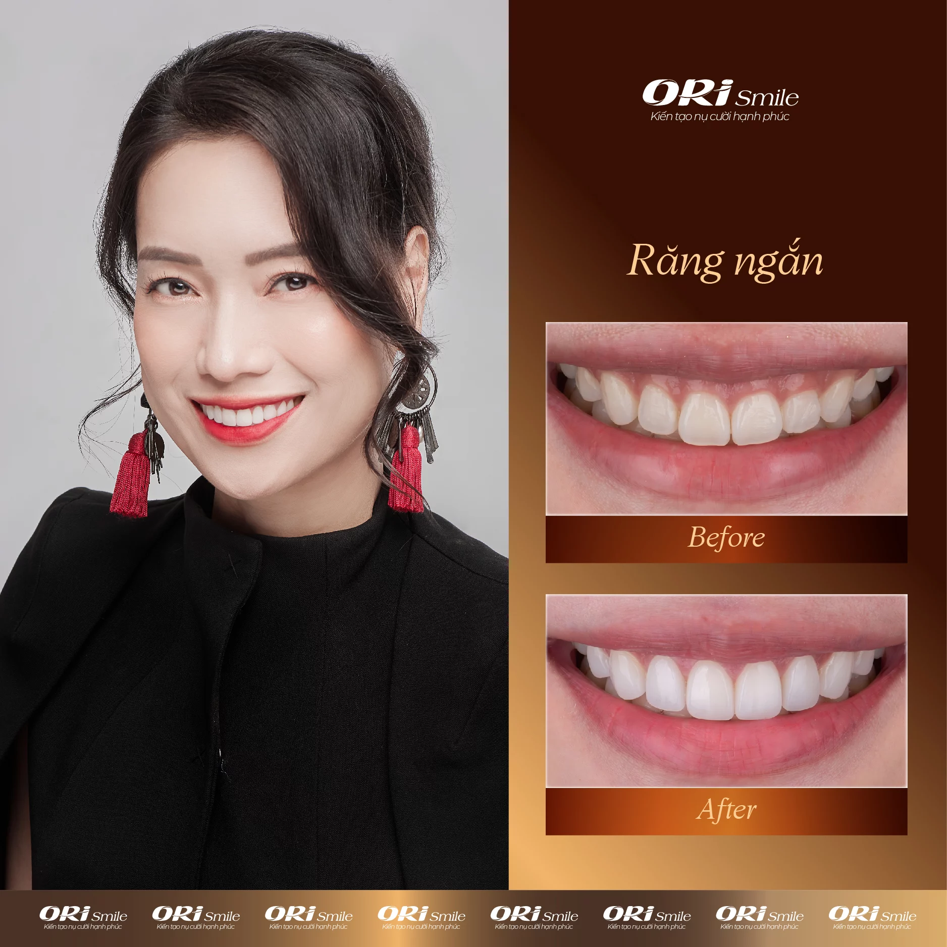 Hình ảnh khách hàng sử dụng dịch vụ tại Ori Smile