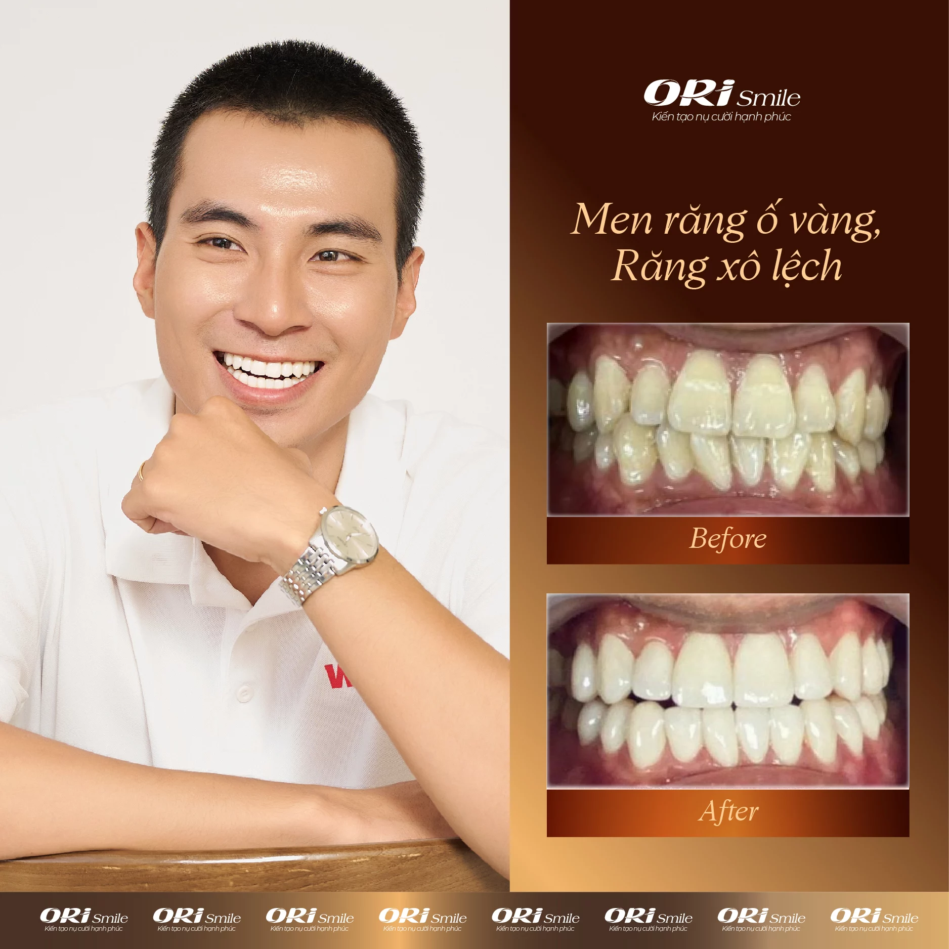 Hình ảnh khách hàng sử dụng dịch vụ tại Ori Smile